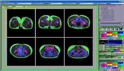 Tomovision sliceOmatic32位5.0.9.1.1