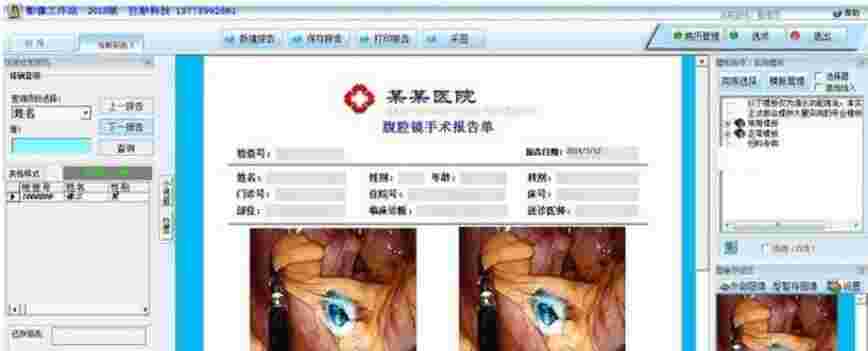 腹腔镜影像工作站v2015